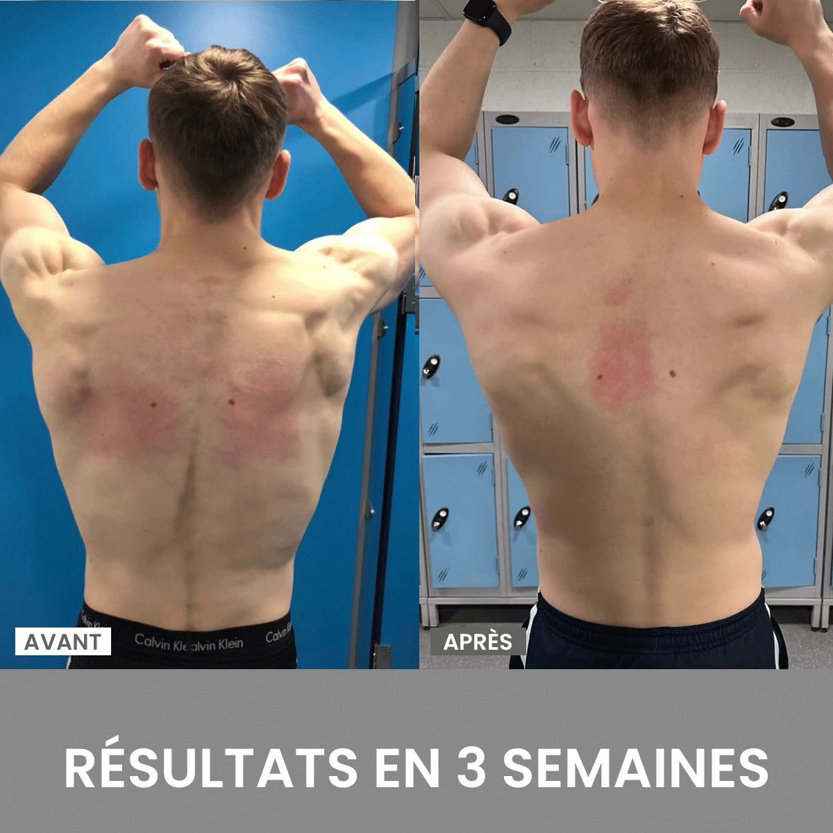 Correcteur de Posture – Améliorez Votre Posture Instantanément! (1 Acheté, 1 Offert)